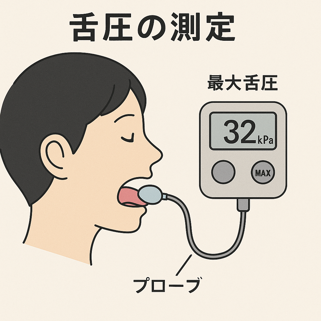 舌圧の測定イメージ：プローブを舌に当て、最大舌圧を kPa で表示