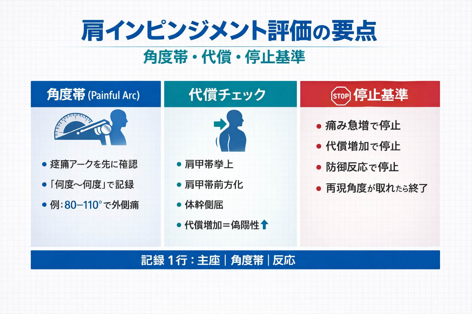 肩インピンジメント評価の要点（角度帯・代償・停止基準）を示した図解