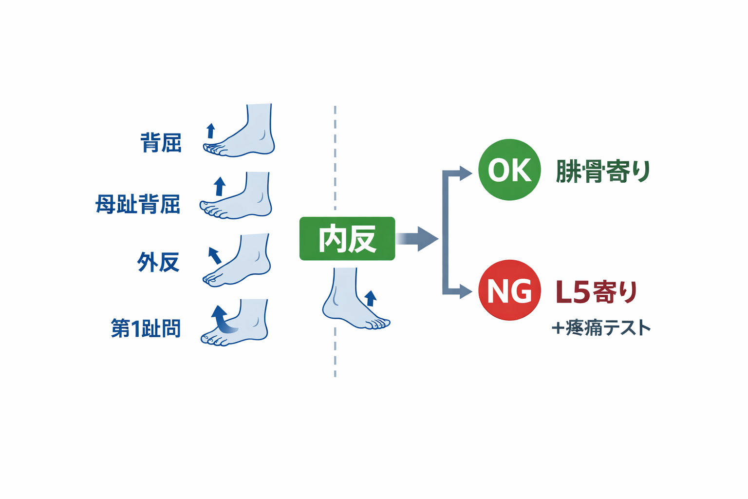 下垂足の鑑別：腓骨神経麻痺と L5 神経根障害を内反 1 回で分ける最小セット