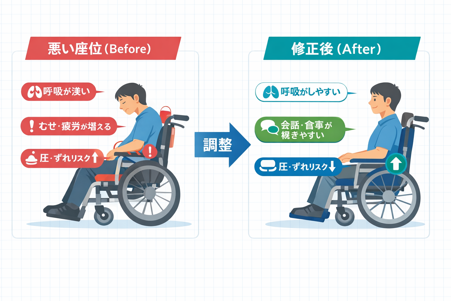 ALS のシーティング比較図。左は骨盤後傾と頭頸部前方化がある悪い座位、右は骨盤中間位と頭頸部中間位に修正し呼吸・嚥下・圧管理が改善した座位。