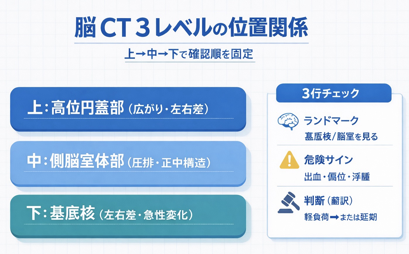 脳 CT 3 レベル（高位円蓋部・側脳室体部・基底核）の位置関係と 3 行チェック（ランドマーク・危険サイン・判断）