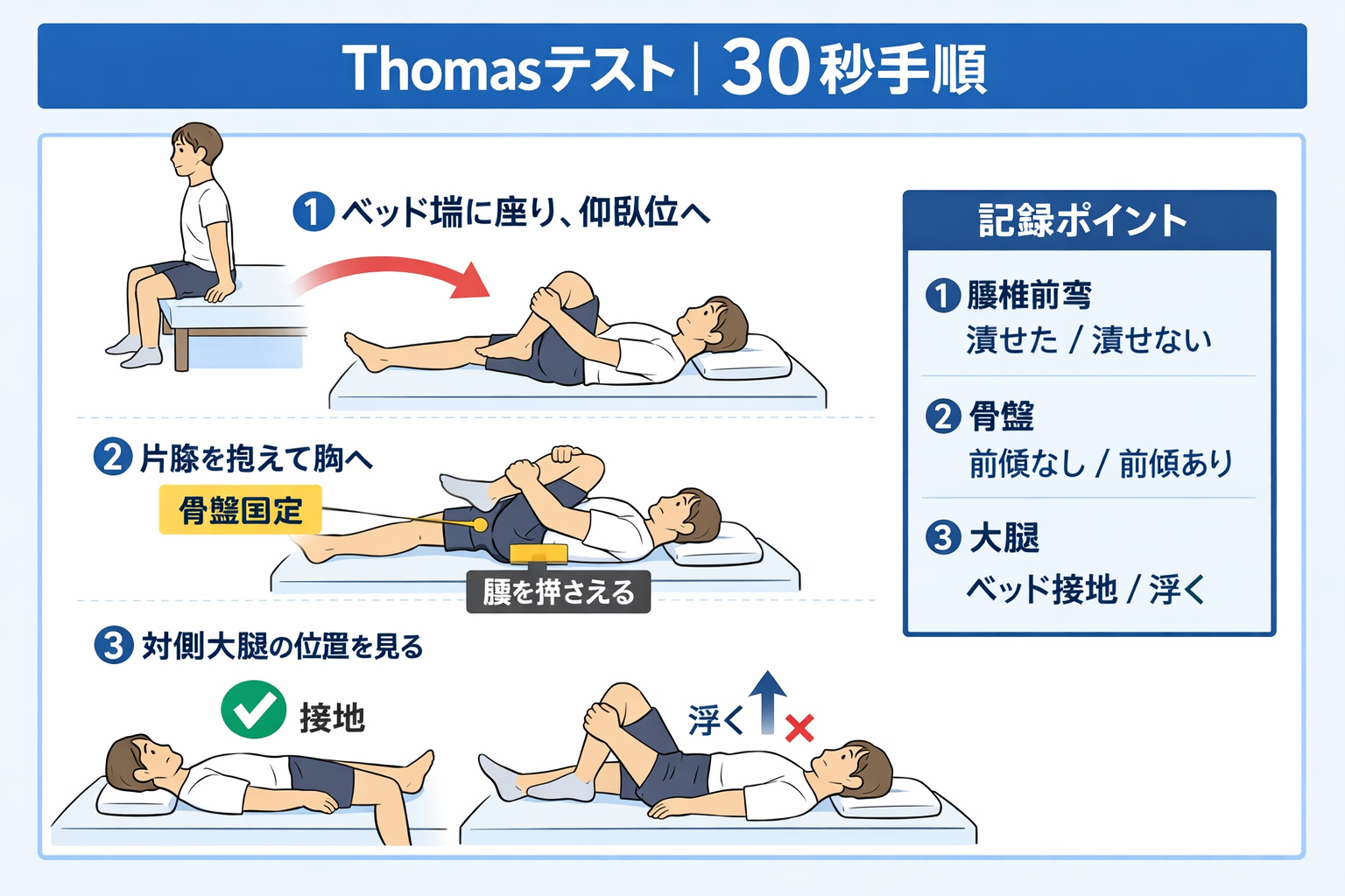 Thomas テスト 30 秒手順の図解（骨盤固定・腰椎前弯・対側大腿位置の確認）