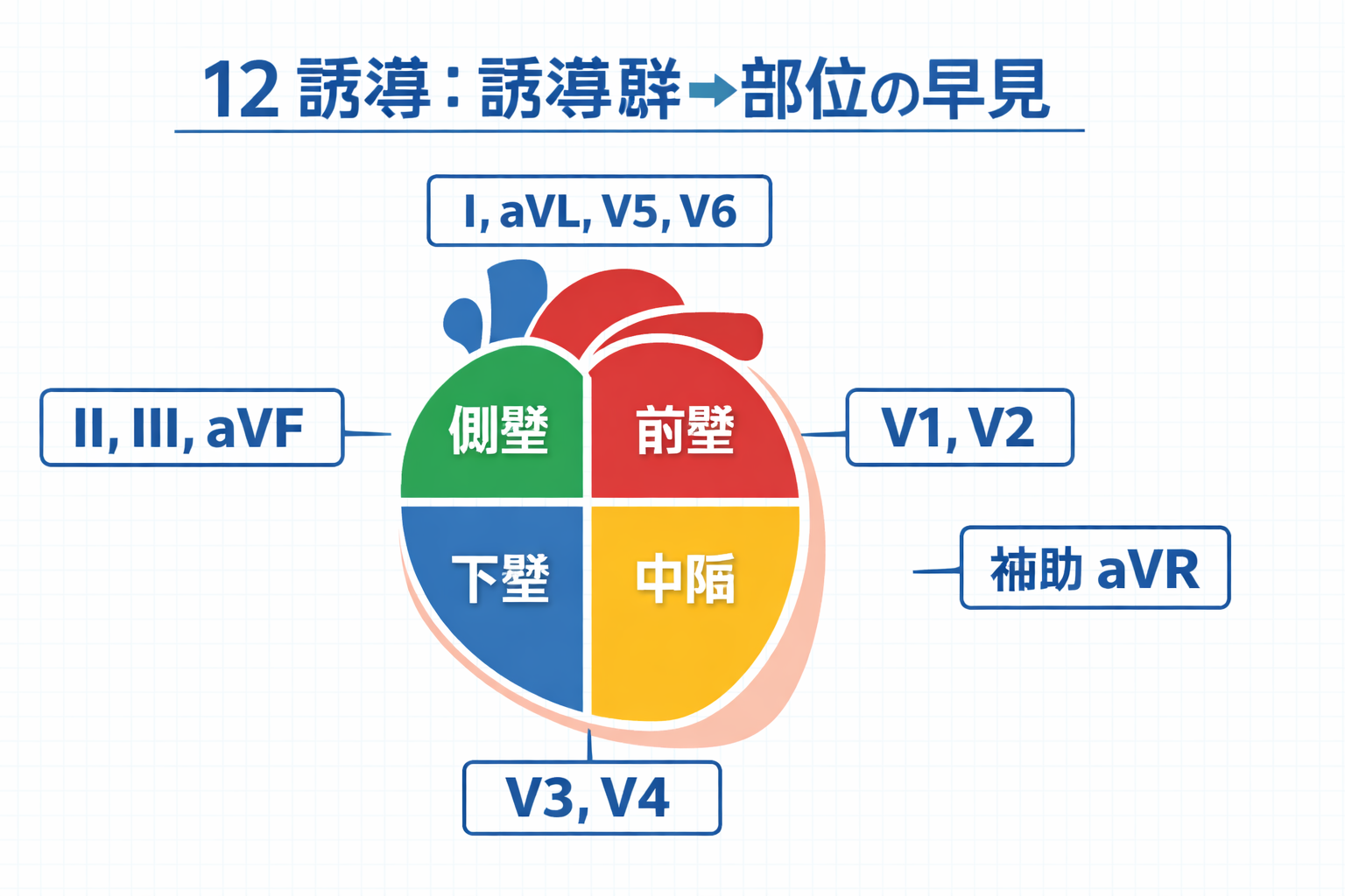12 誘導：誘導群&rarr;部位の早見（下壁・側壁・前壁・中隔）