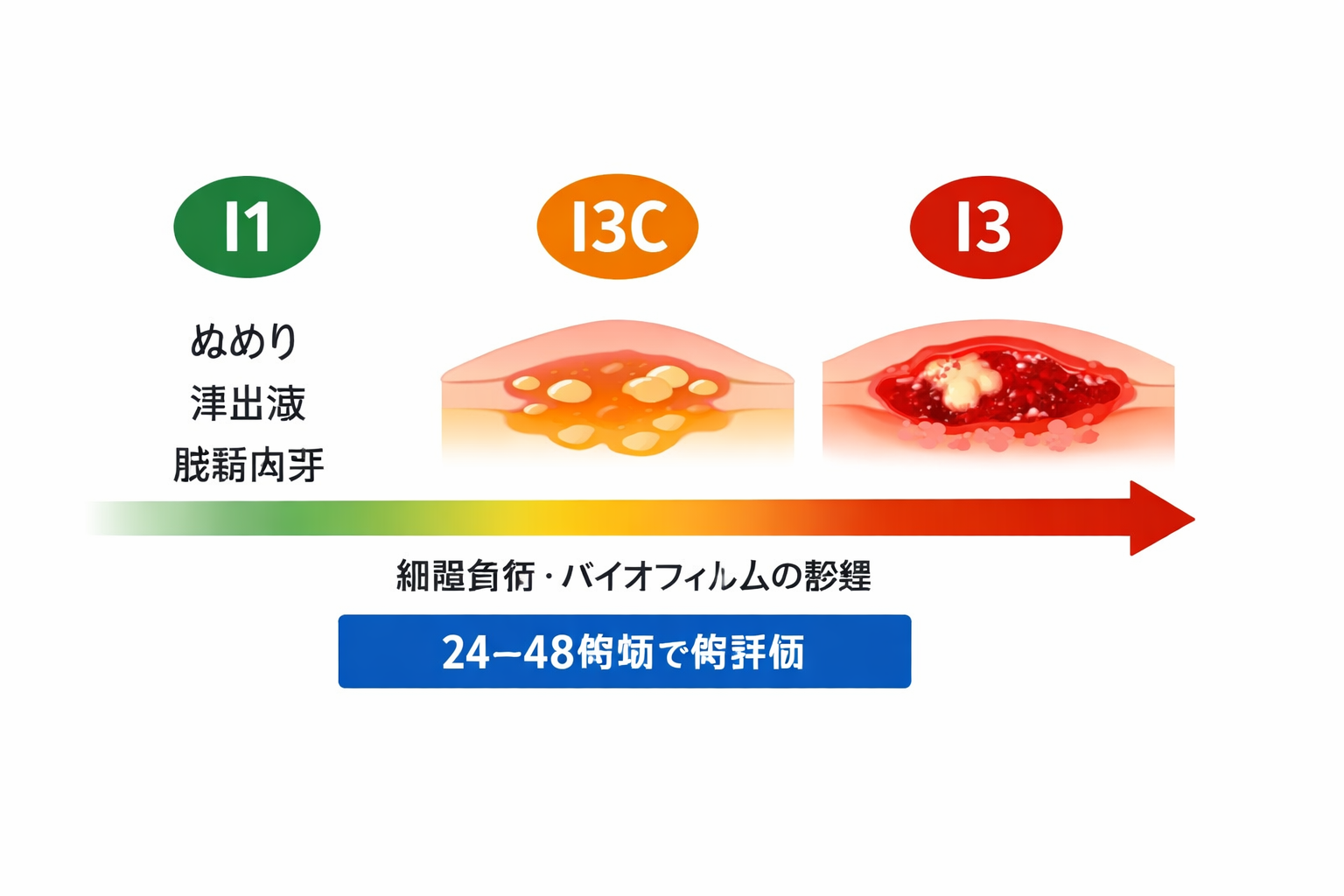 I1・I3C・I3 の連続体（概念図）