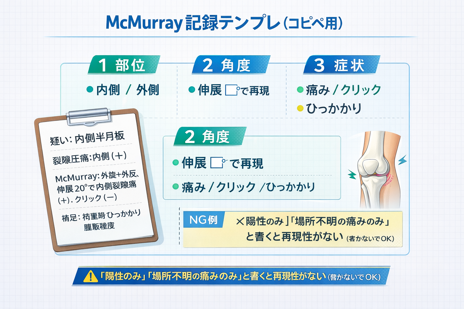 McMurrayテストの内側・外側での方向早見図（回旋と外反・内反、伸展時の確認ポイント）