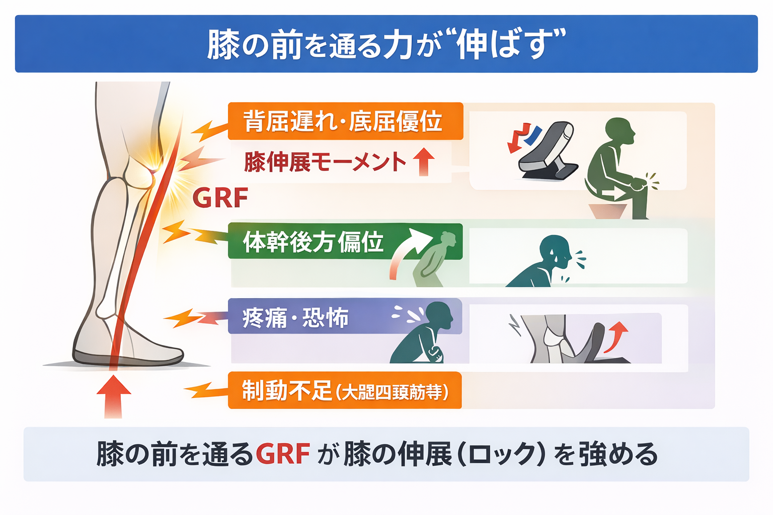 膝の前を通る GRF が膝の伸展（ロック）を強める：スイッチ 4 つ（背屈遅れ・底屈優位／体幹後方偏位／疼痛・恐怖／制動不足）
