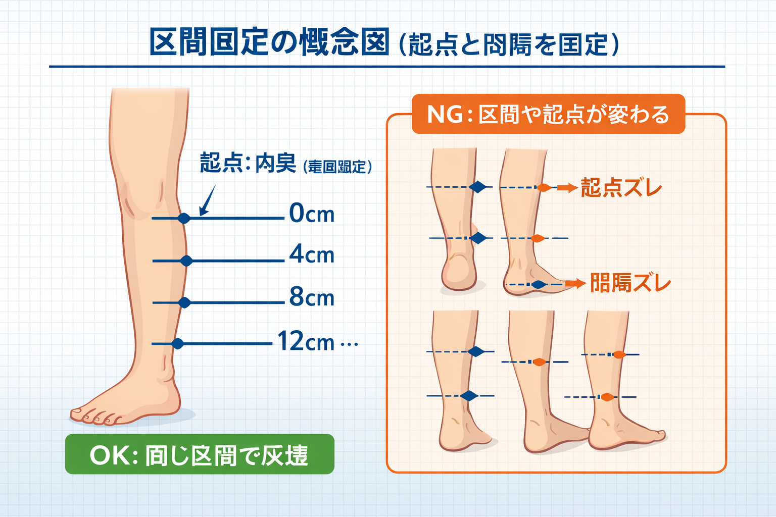 浮腫評価における区間固定の概念図。内果を起点に 4 cm 間隔で周径測定点を設定する例
