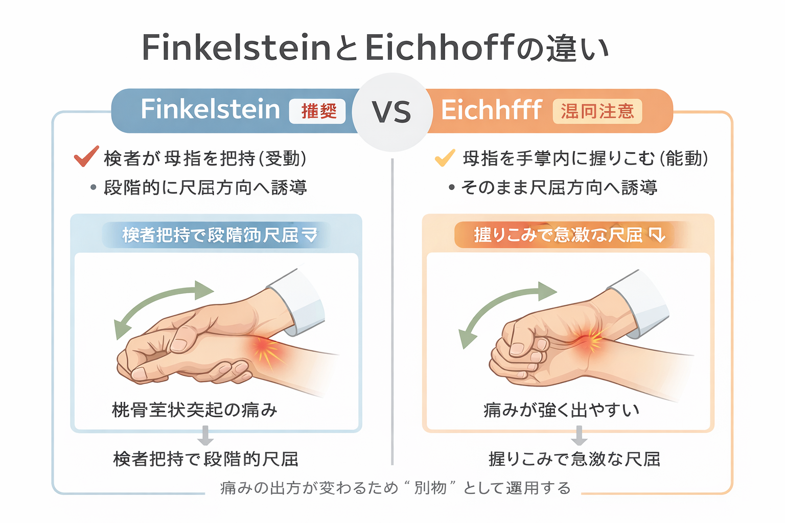 Finkelstein テストと Eichhoff テストの違い（手順・痛みの出方）