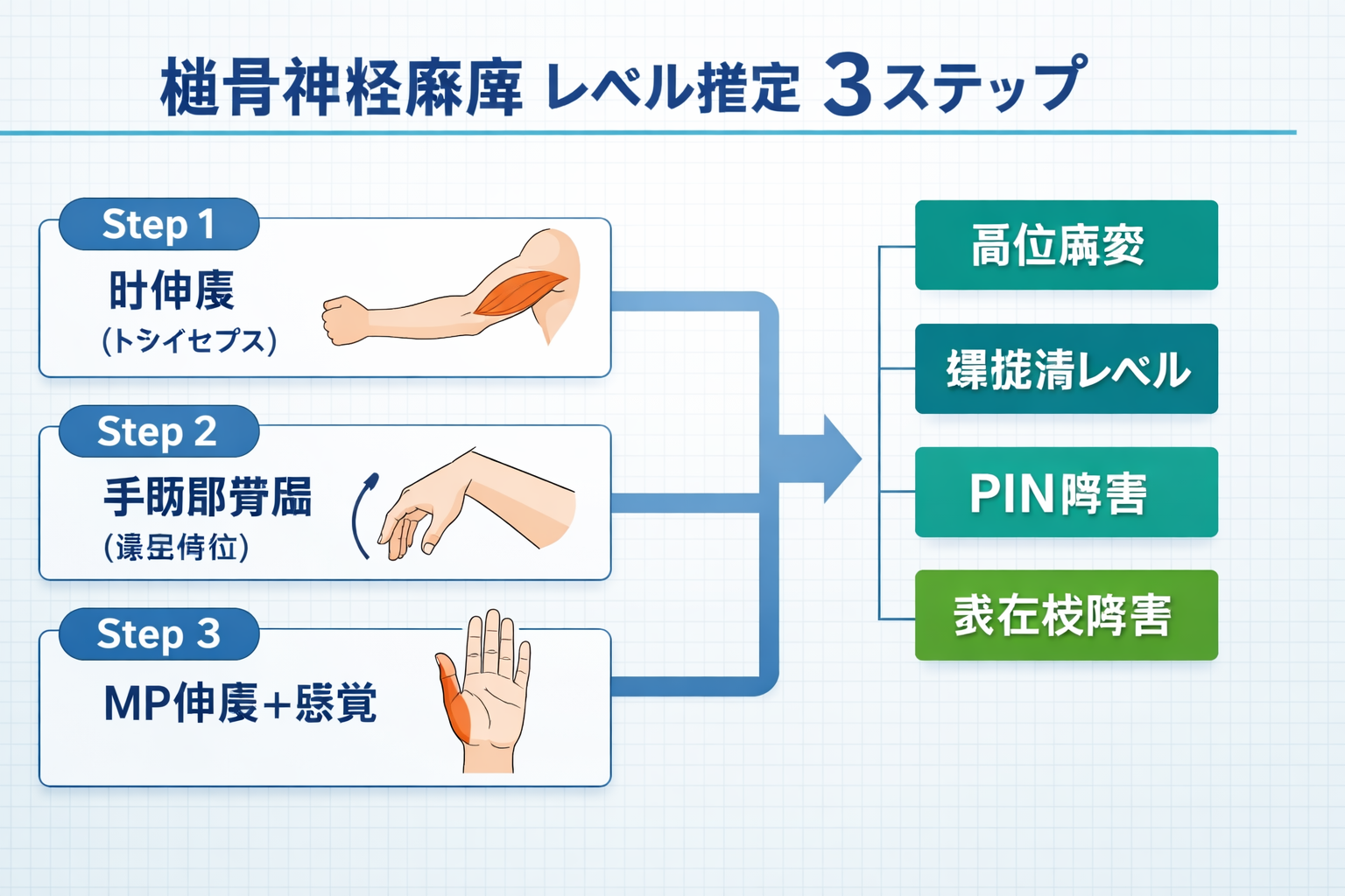 橈骨神経麻痺の障害レベルを3ステップで推定する図解（肘伸展・手関節背屈・MP伸展と感覚）