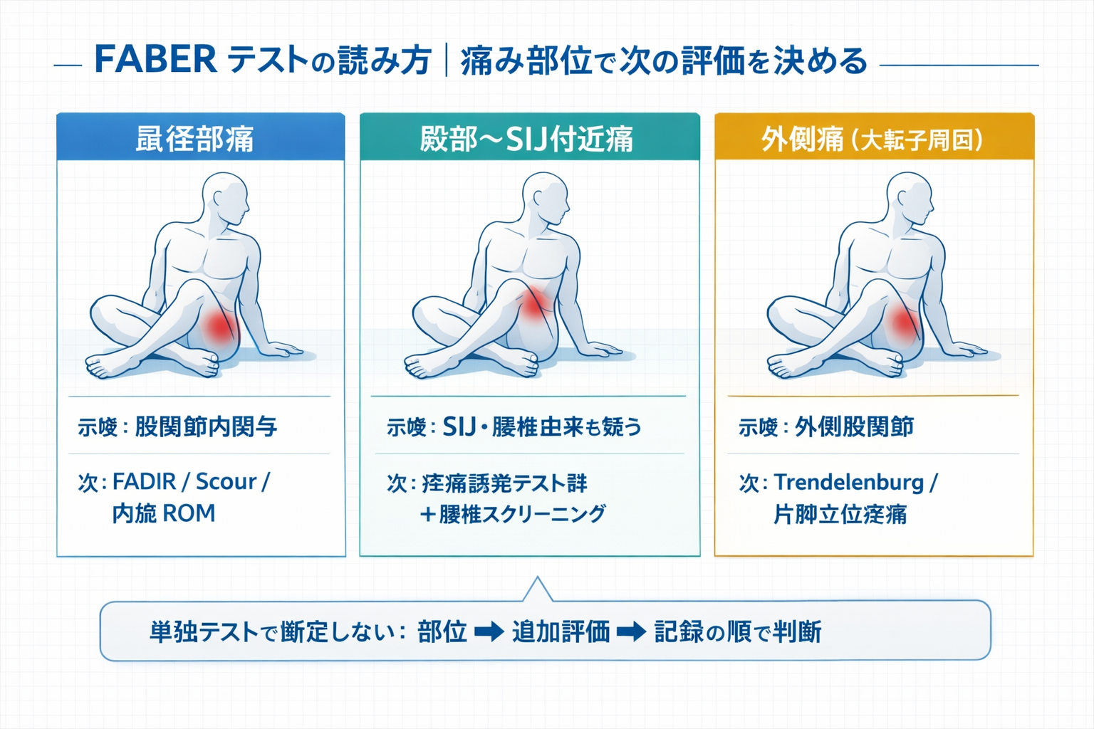 FABER テストの痛み部位別の読み分けと次の評価フロー（鼠径部・殿部/SIJ・外側）