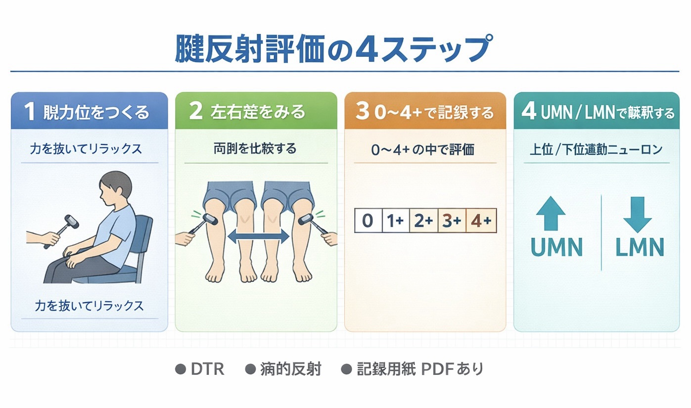 腱反射評価の 4 ステップをまとめた図版