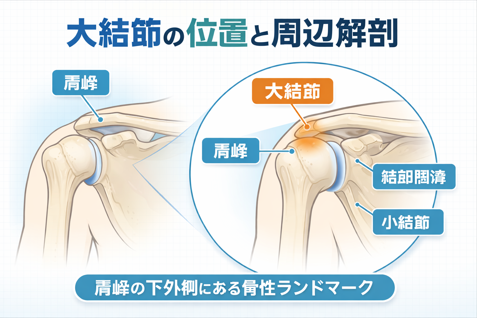 大結節の位置と周辺解剖を示した図版