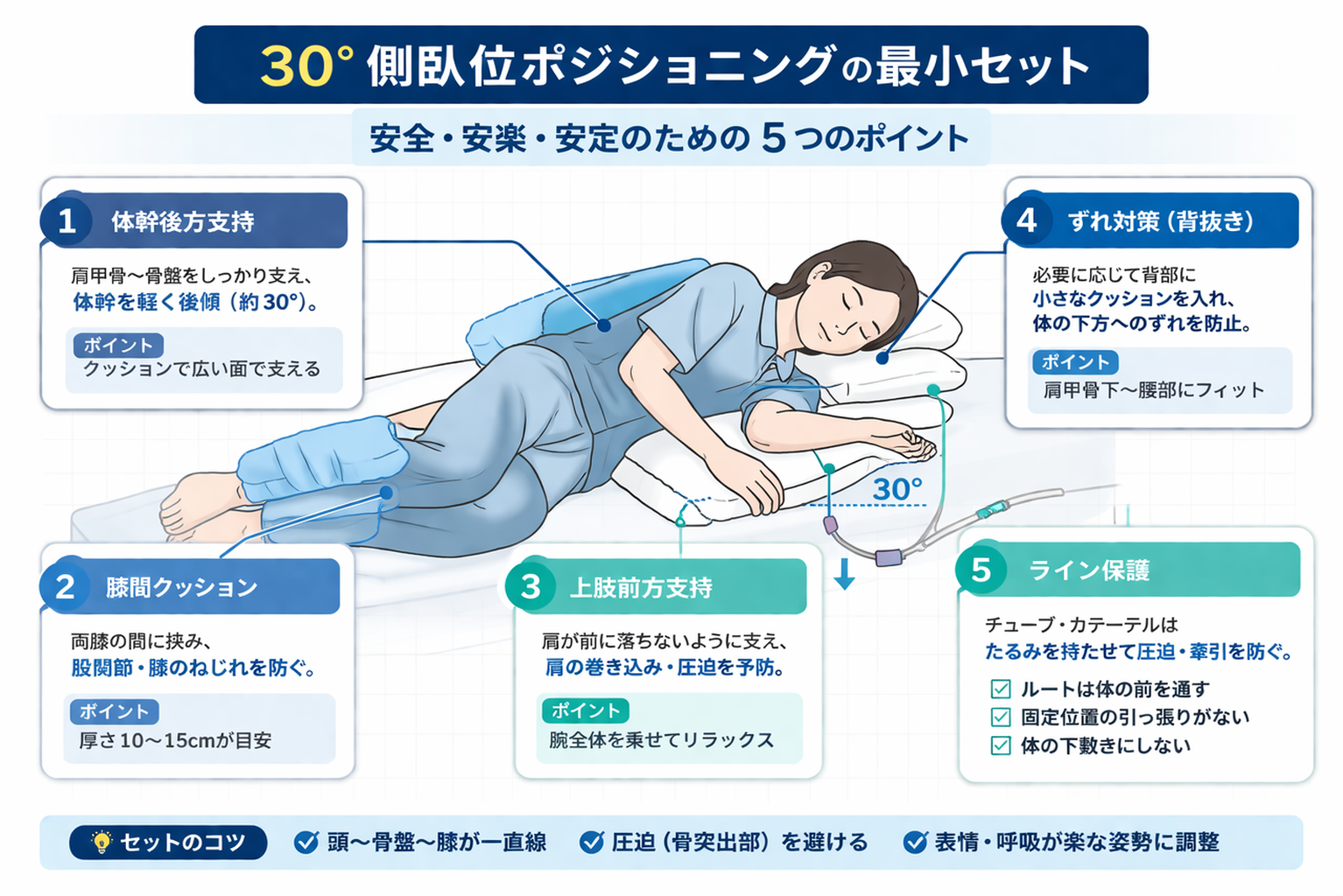 30&deg; 側臥位ポジショニングの最小セット図。体幹後方支持、膝間クッション、上肢前方支持、ずれ対策、ライン保護の 5 点を示した図。