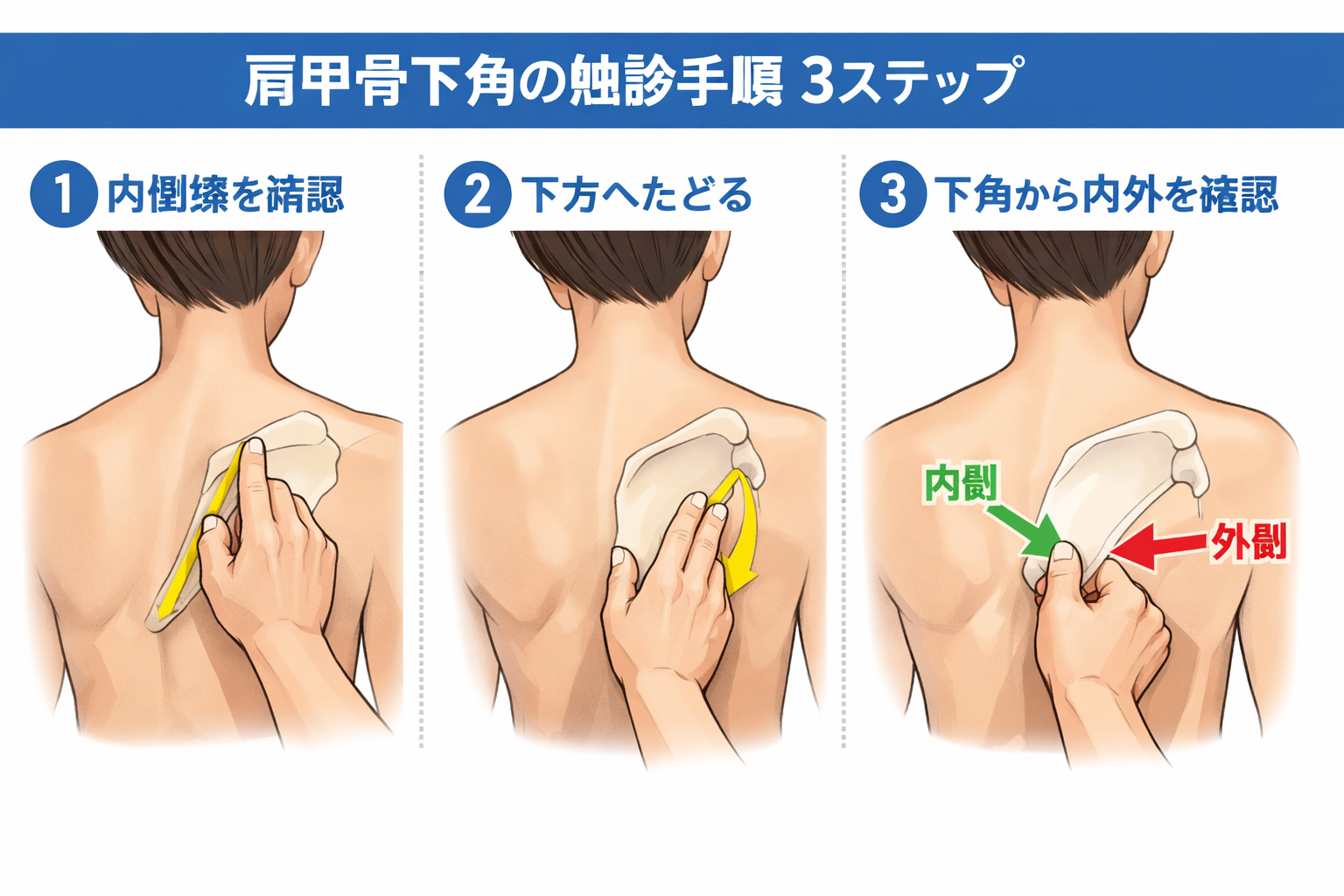 肩甲骨下角の比較図