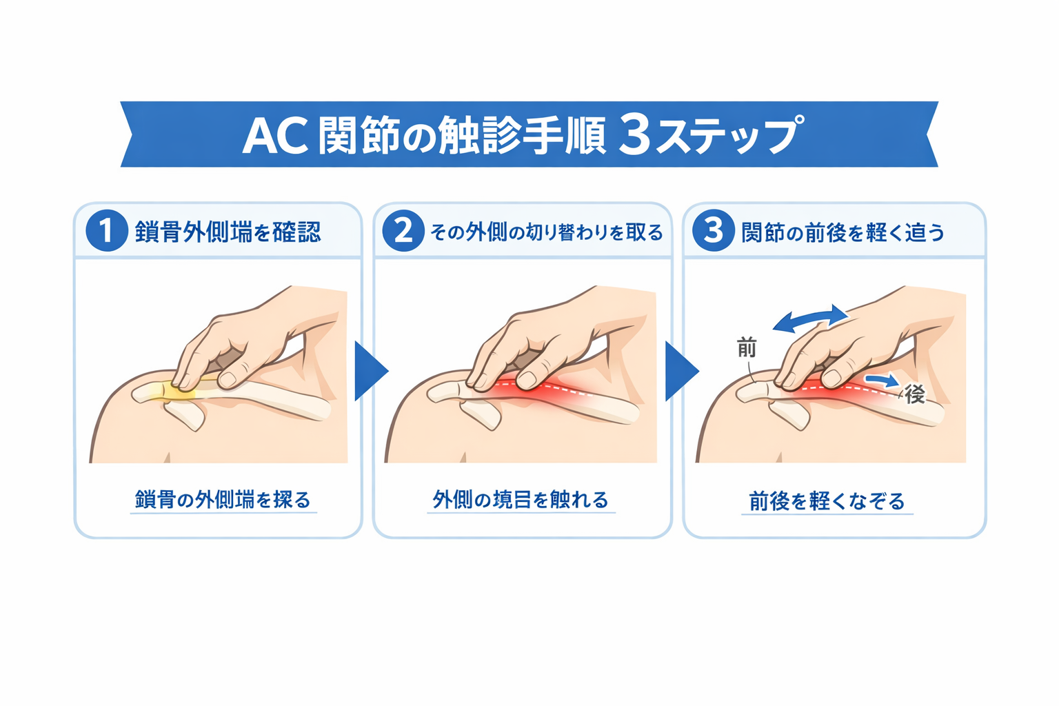AC 関節と間違えやすい部位を比較した図版