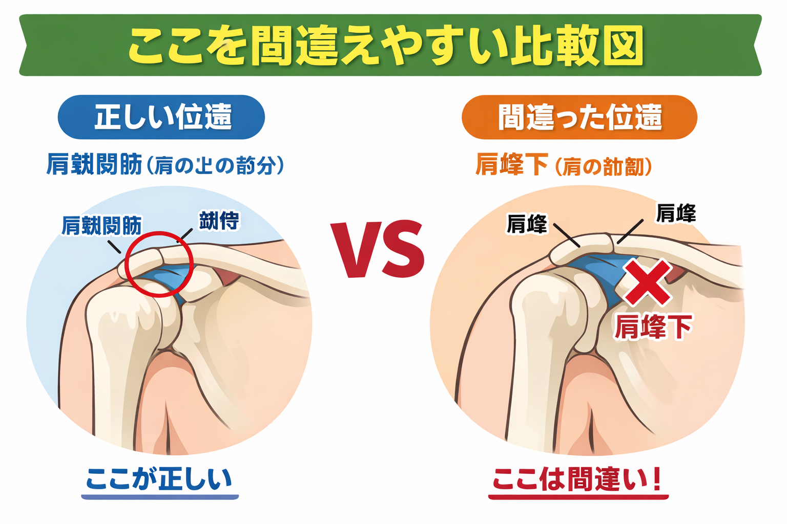 AC 関節の触診手順 3 ステップを示した図版
