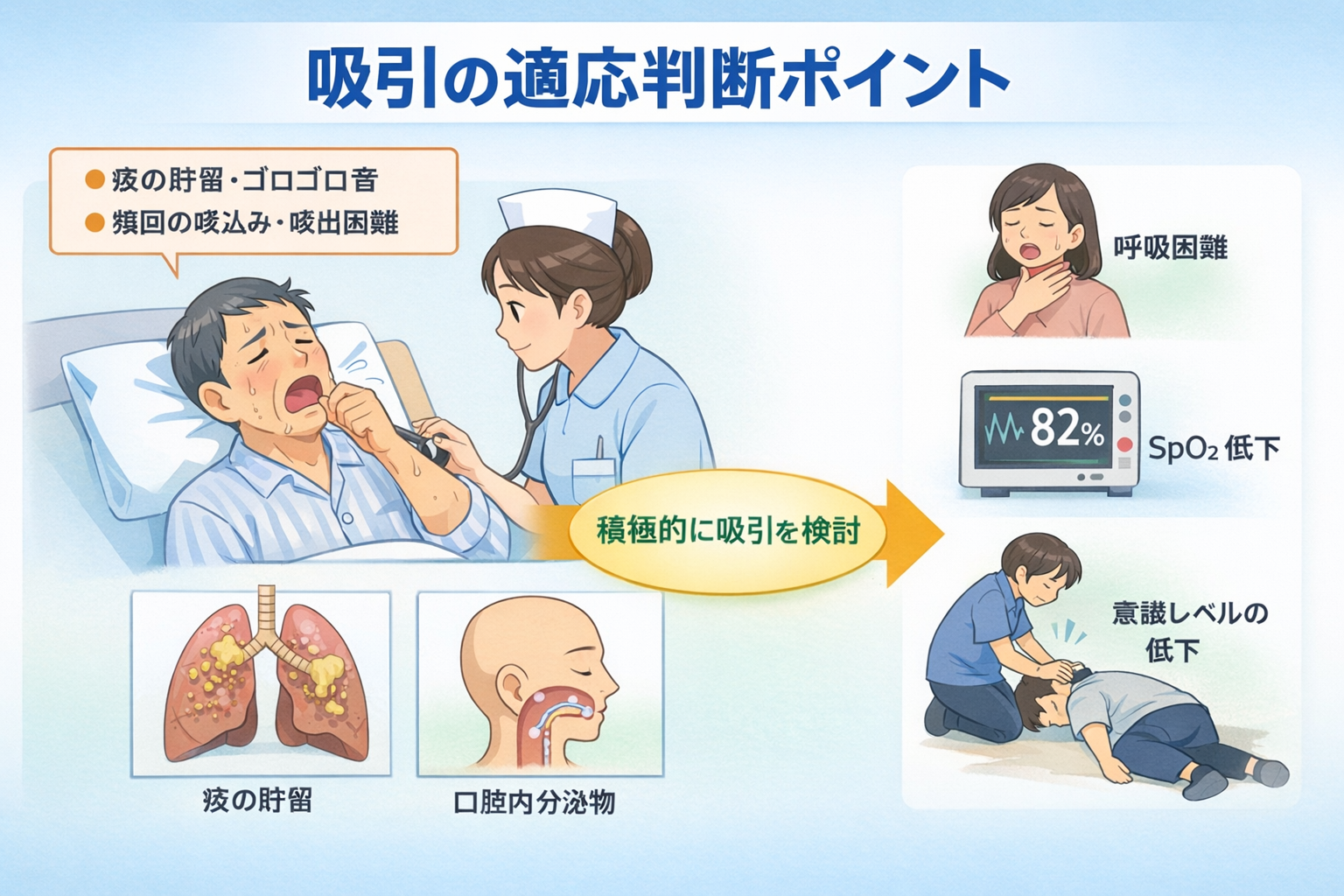 吸引の適応判断ポイントを示した図解
