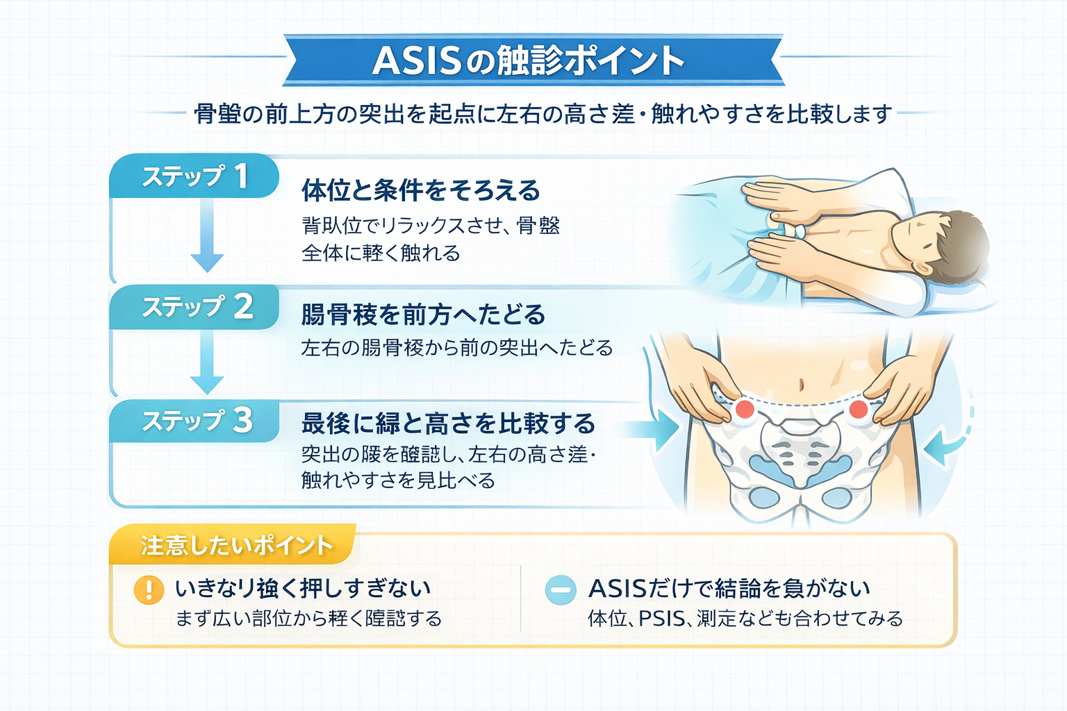 ASIS の触診ポイントを 3 ステップで示した図版