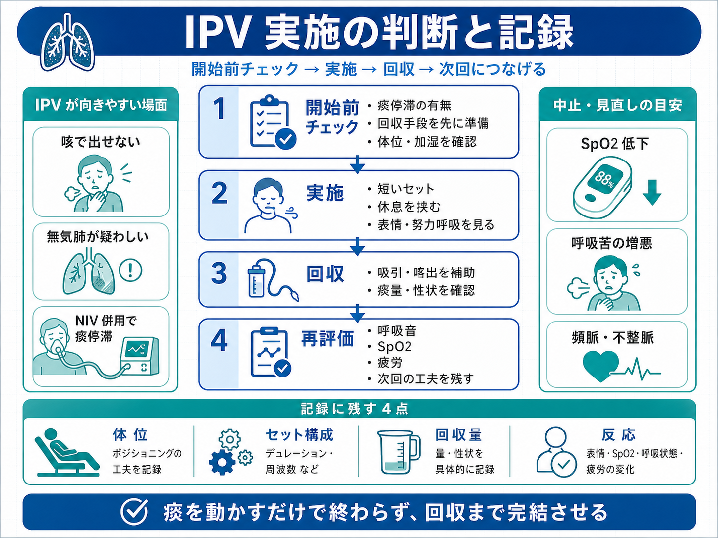 IPV 実施の判断と記録の流れ。開始前チェック、実施、回収、再評価、中止・見直しの目安、記録に残すポイントをまとめた図版