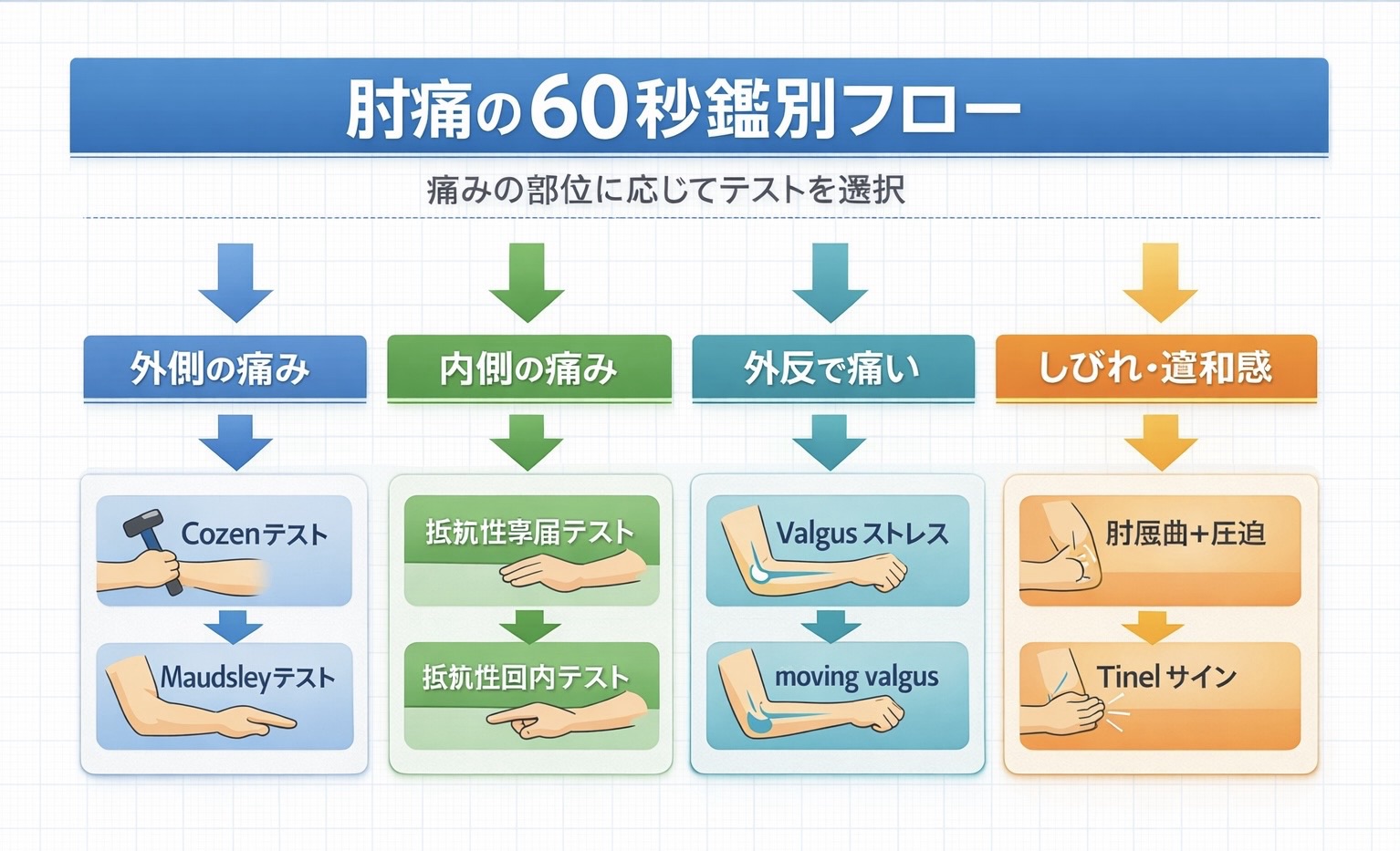 肘痛の 60 秒鑑別フロー図。外側の痛み、内側の痛み、外反で痛い、しびれ・違和感の 4 入口から、Cozen テスト、Maudsley テスト、抵抗性掌屈テスト、抵抗性回内テスト、Valgus ストレス、moving valgus、肘屈曲＋圧迫、Tinel サインへ分岐する記事内図版