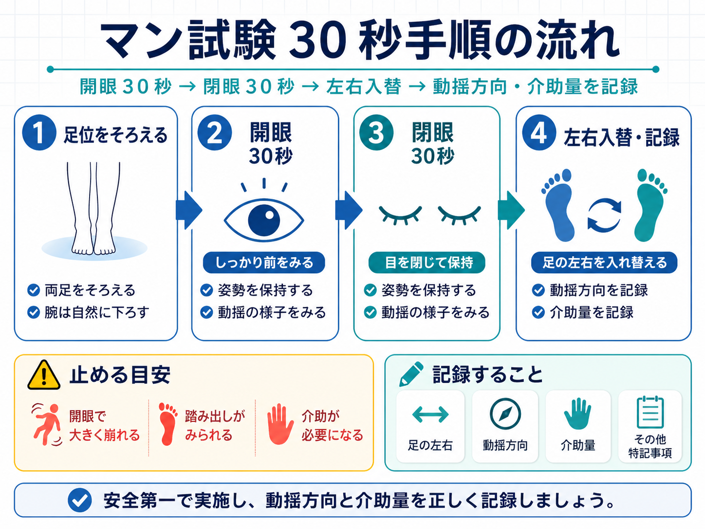 マン試験30秒手順の流れ。足位をそろえる、開眼30秒、閉眼30秒、左右入替と記録の4ステップを示した図版