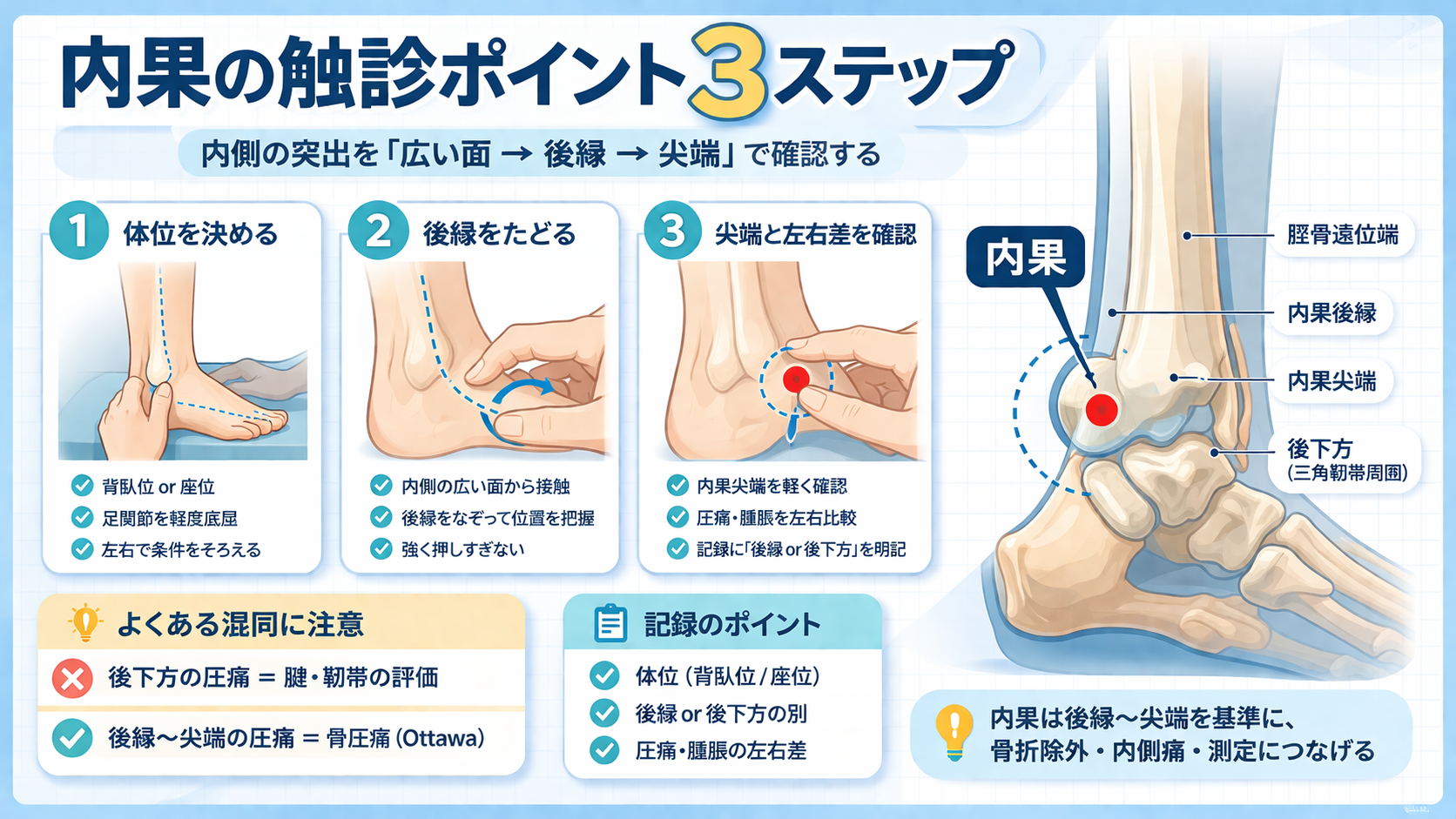 内果の触診ポイントを 3 ステップで示した図版