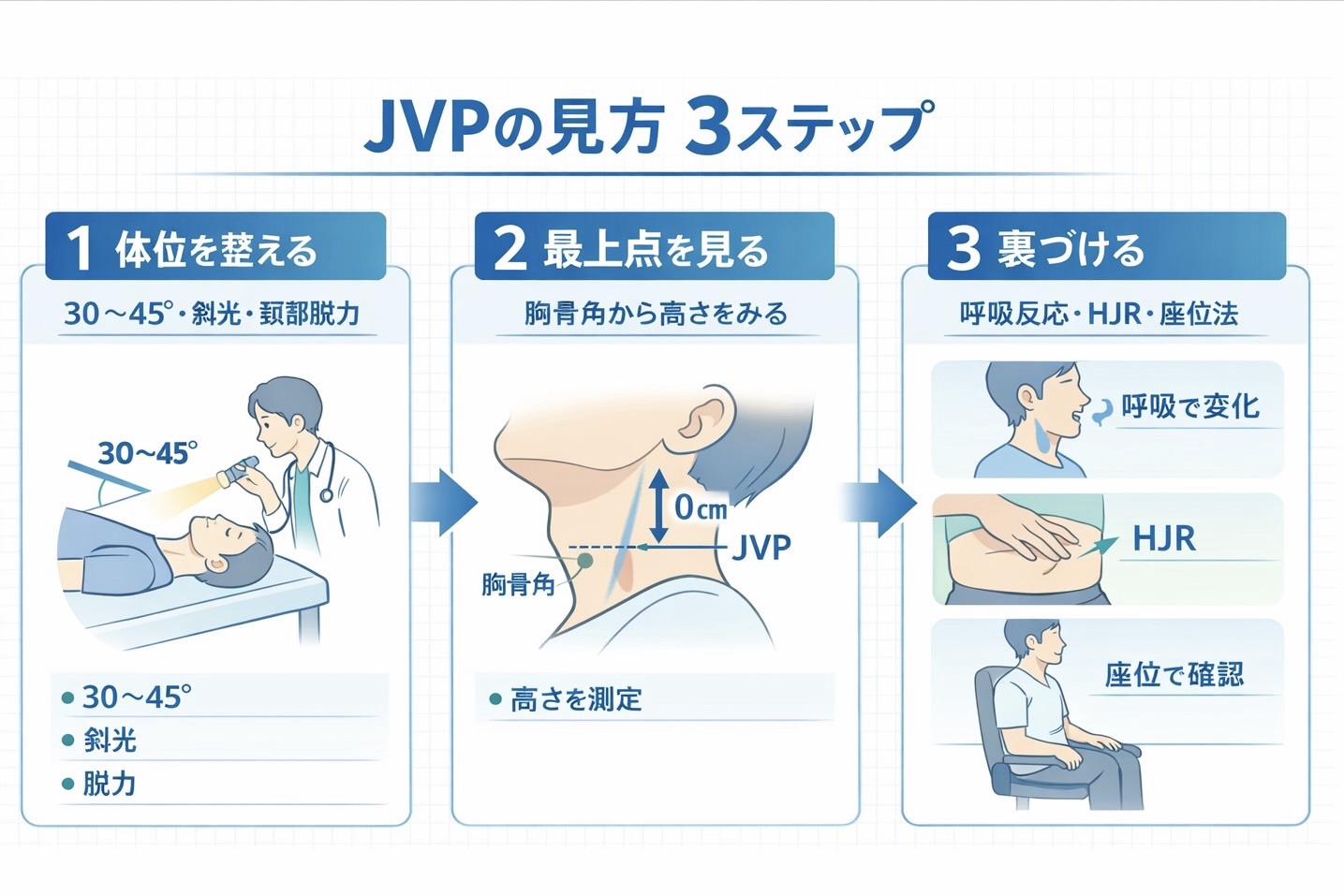 JVP の見方 3 ステップを整理した図版