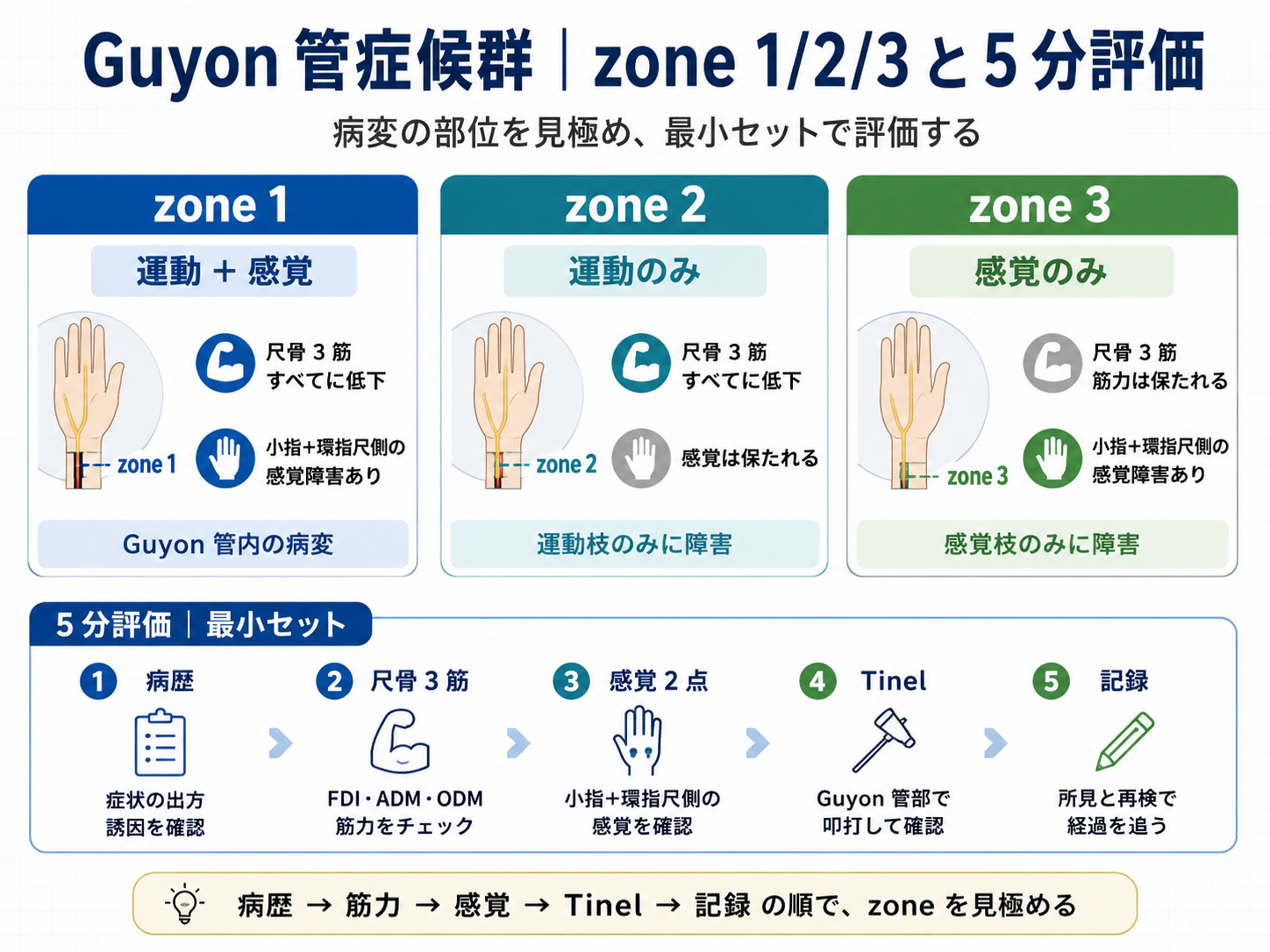Guyon 管症候群の zone 1/2/3 と 5 分評価の図版
