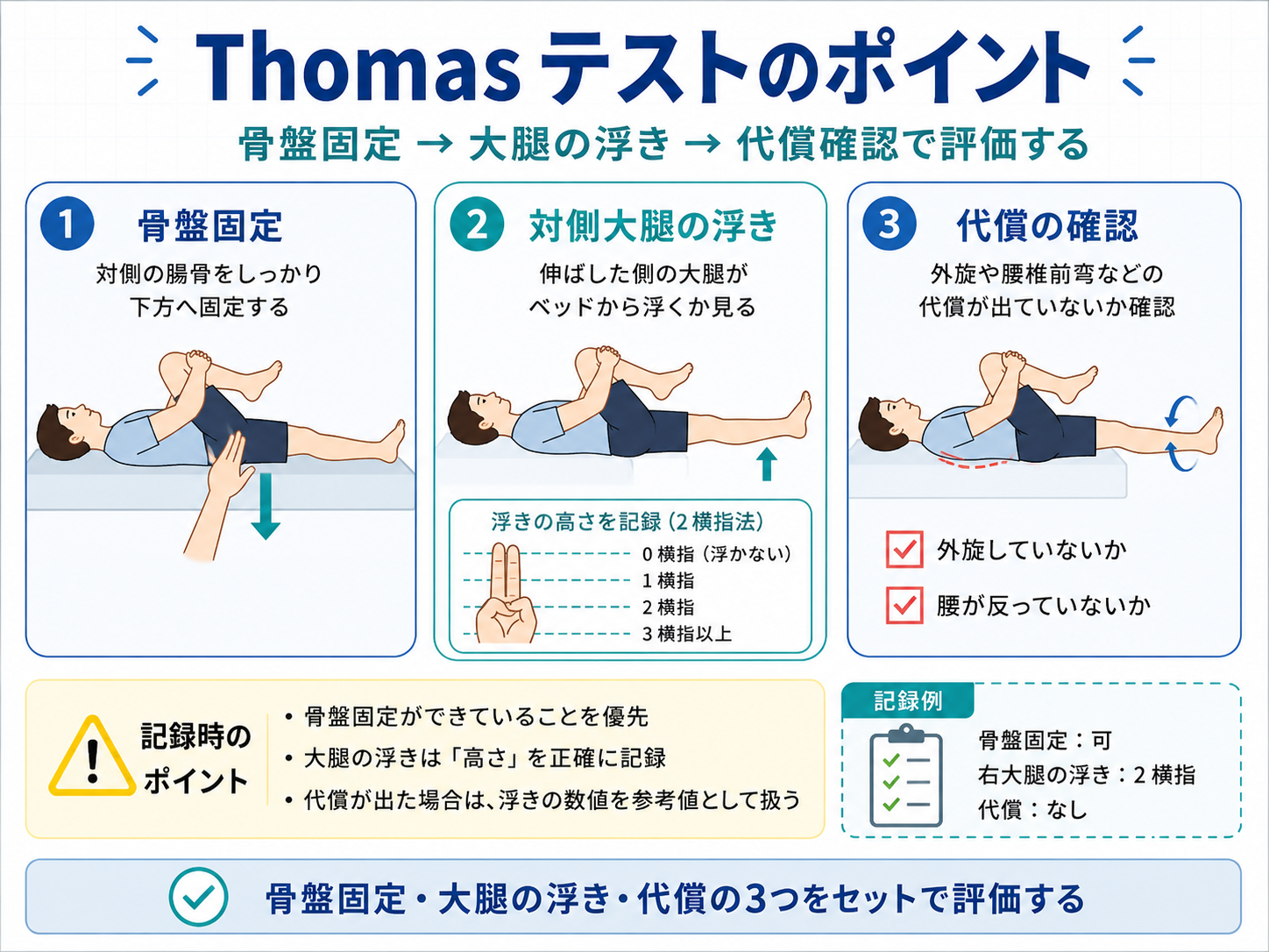 Thomas テストのポイントを骨盤固定・大腿の浮き・代償確認の3点で整理した図解