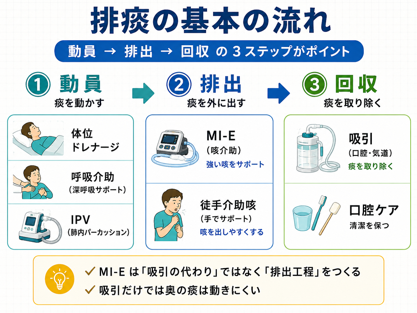 排痰の基本の流れ。動員、排出、回収の 3 ステップで MI-E の位置づけを整理した図版