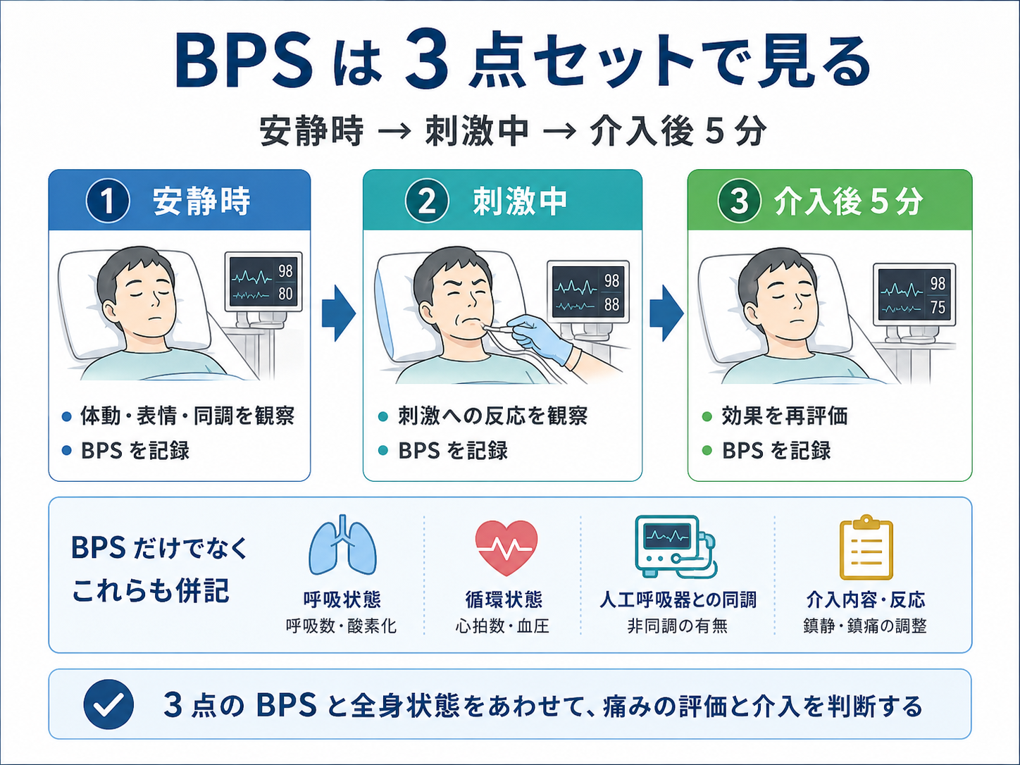 BPS は安静時・刺激中・介入後 5 分の 3 点セットで評価する図版