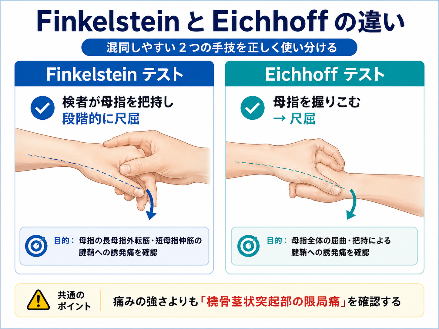Finkelstein テストと Eichhoff テストの違い