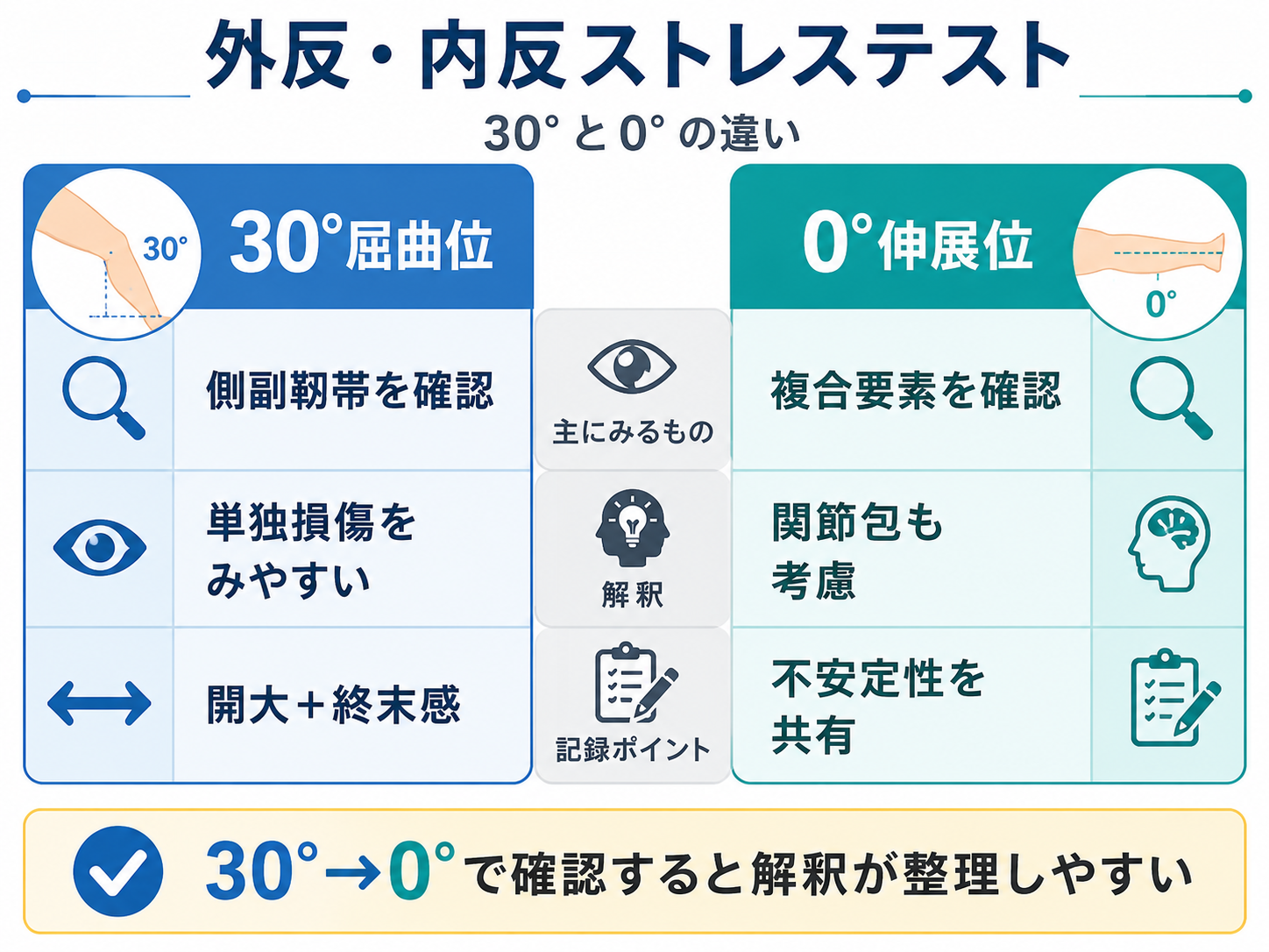 外反・内反ストレステストにおける30&deg;屈曲位と0&deg;伸展位の違いを比較した図版
