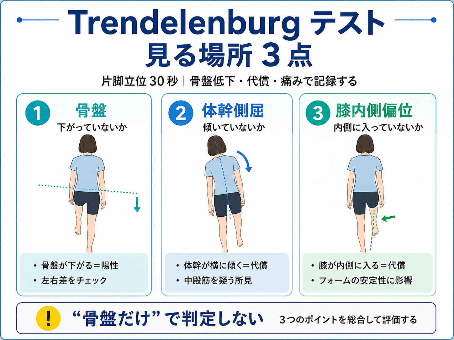 Trendelenburg テストで見る場所3点（骨盤・体幹側屈・膝内側偏位）を整理した図版