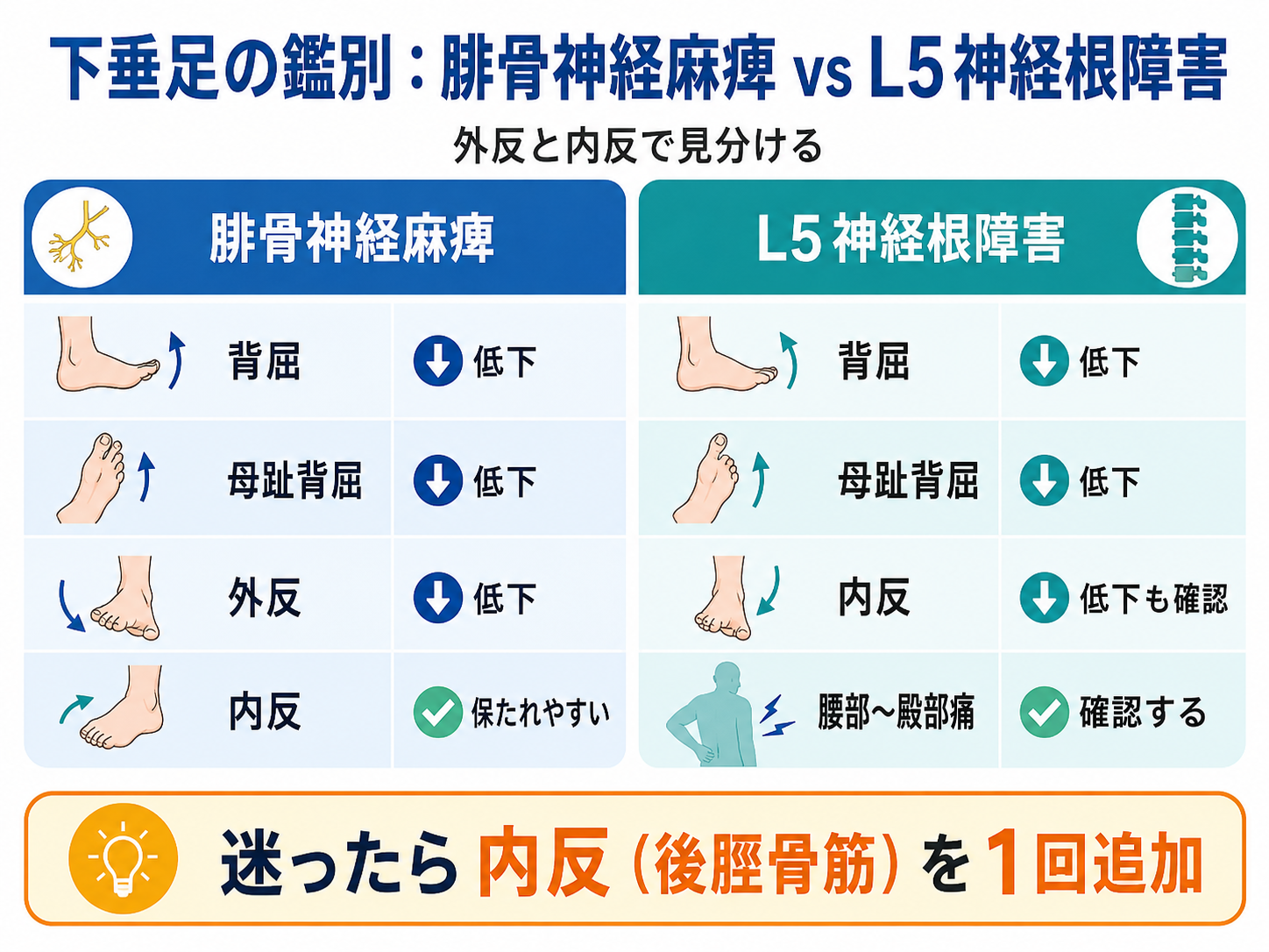 下垂足の鑑別：腓骨神経麻痺とL5神経根障害の比較