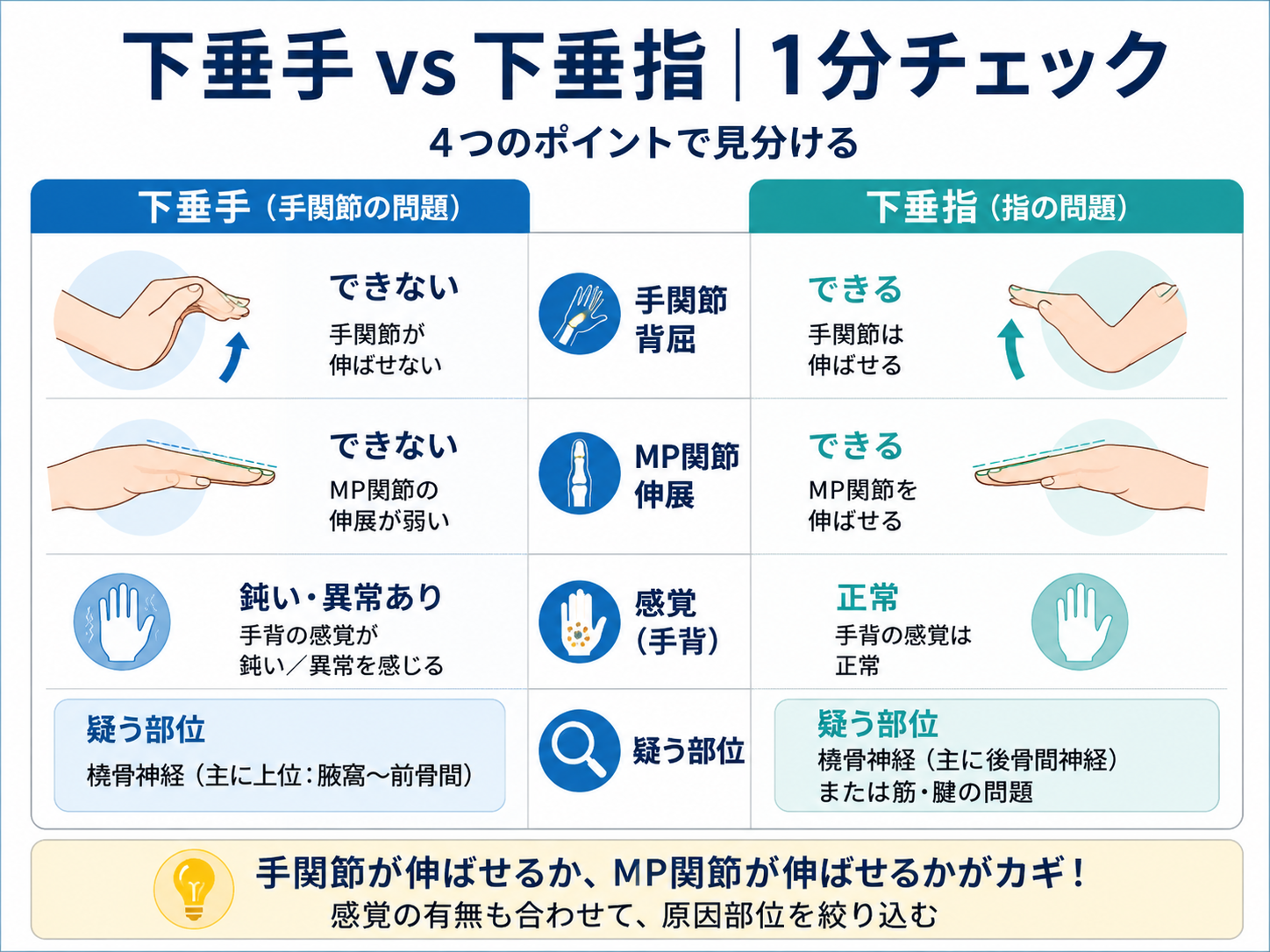下垂手と下垂指を1分で見分ける比較図。手関節背屈、MP関節伸展、感覚、疑う部位の違いを整理