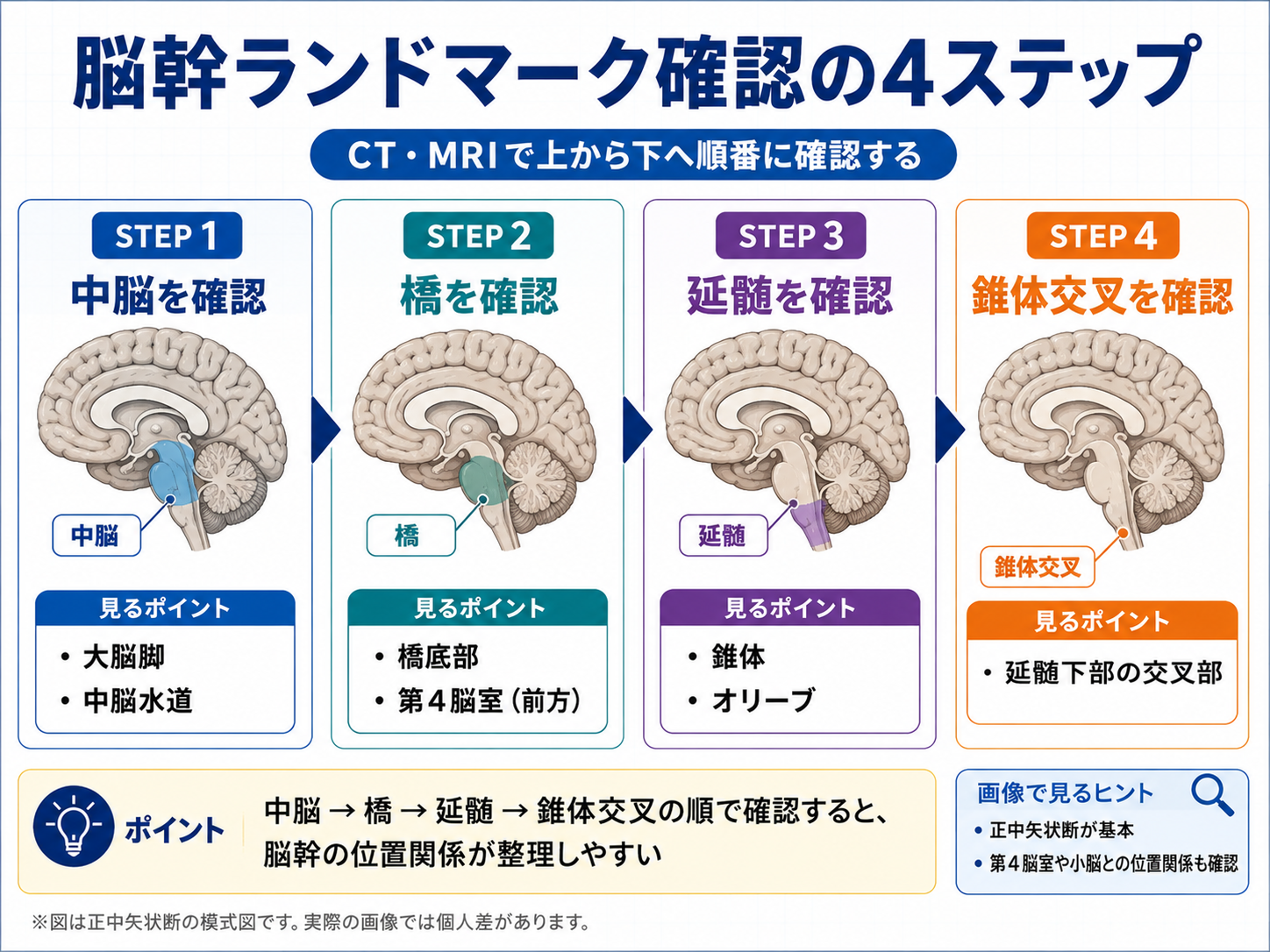 脳幹ランドマークをCT・MRIで確認する順番を示した図。中脳、橋、延髄、錐体交叉の位置関係を整理している。