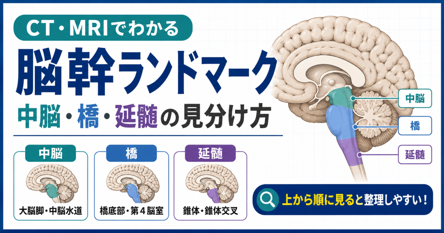 脳幹ランドマーク|中脳・橋・延髄の見分け方 | rehabilikun