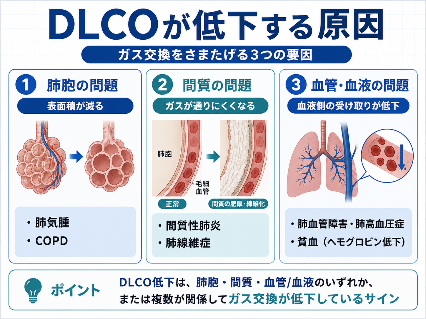 DLCOが低下する原因を整理した図。肺胞の問題、間質の問題、血管・血液の問題の3つに分けて示している。