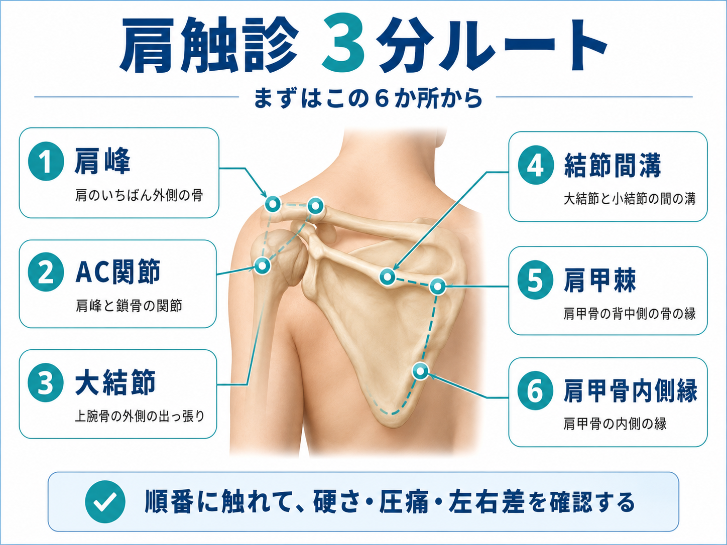 肩触診3分ルートの早見図。肩峰、AC関節、大結節、結節間溝、肩甲棘、肩甲骨内側縁の順番を示した図版
