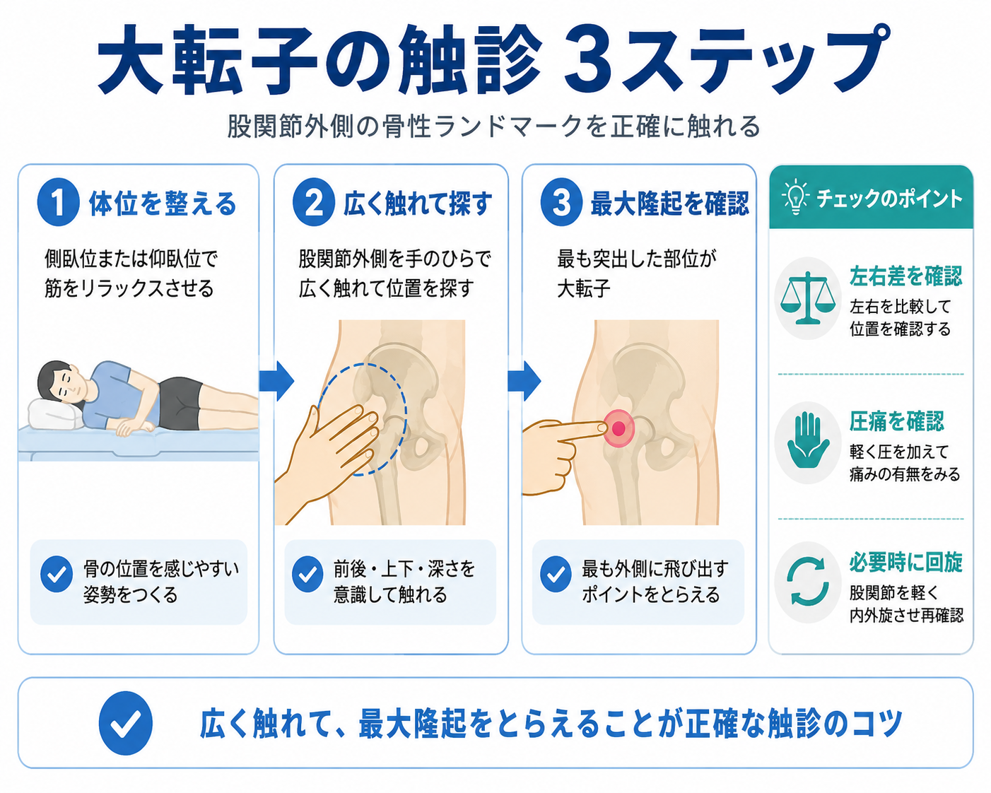 大転子の触診3ステップを示した図版