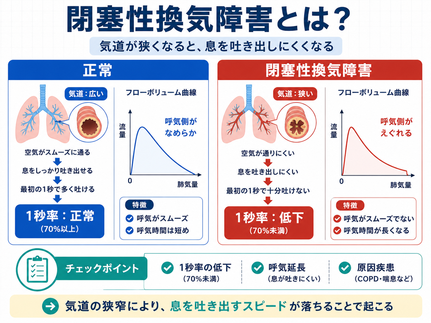 閉塞性換気障害の考え方を示した図。正常と閉塞性換気障害を比較し、気道の狭さ、呼気のしにくさ、1秒率低下を整理している。