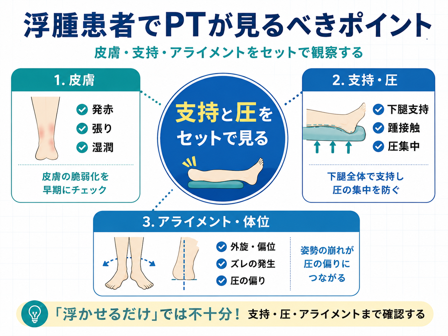 浮腫患者でPTが見るべき皮膚・支持・アライメントのポイントを整理した図版