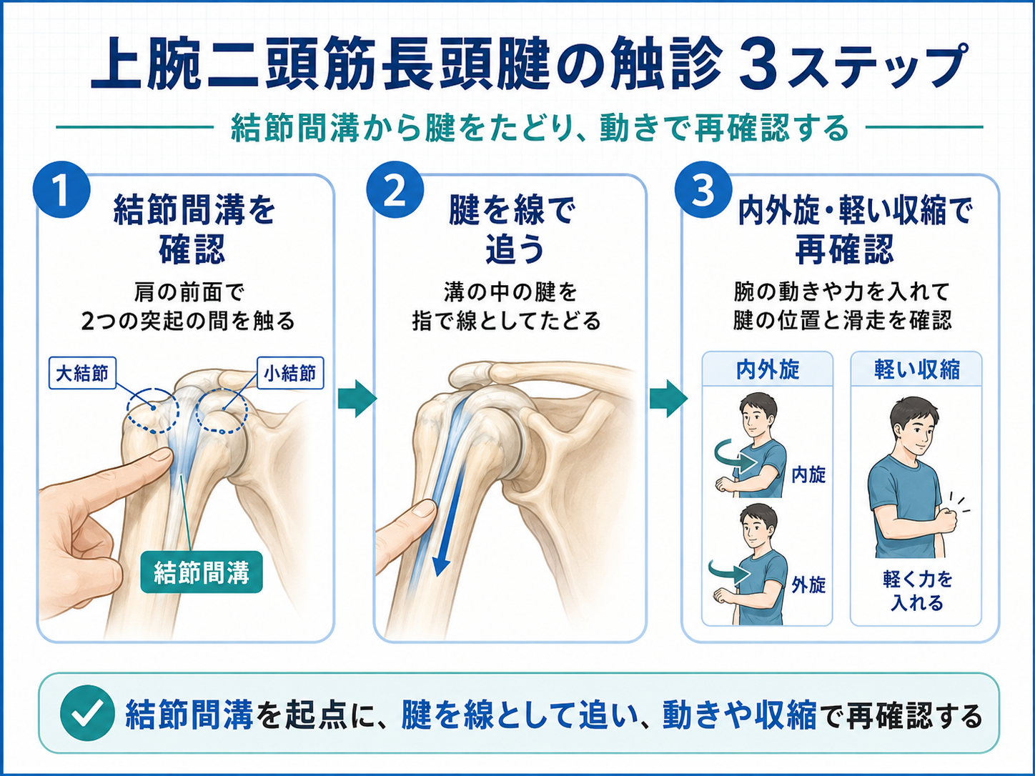 上腕二頭筋長頭腱の触診を結節間溝から3ステップで確認する図版