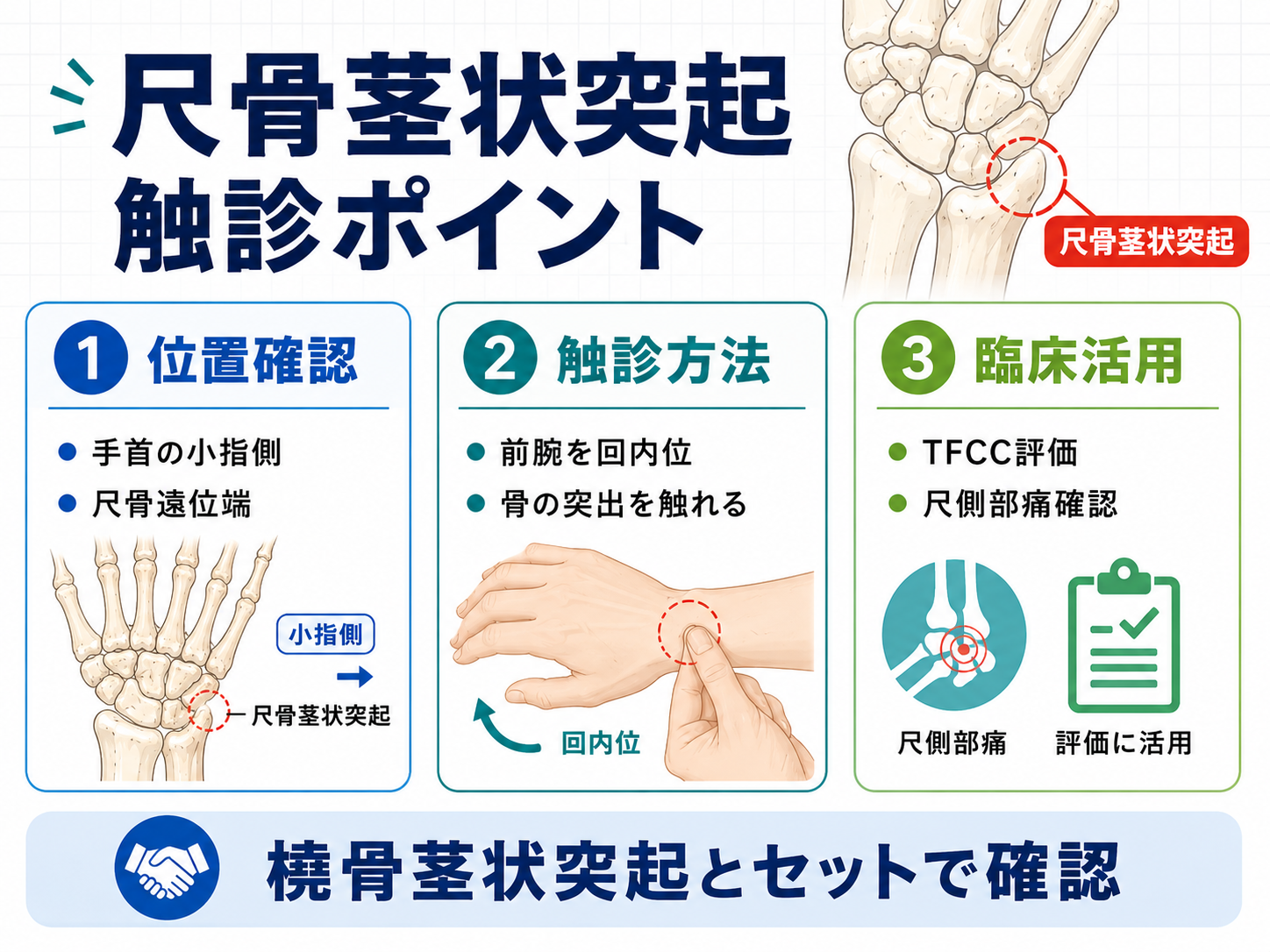 尺骨茎状突起の位置と触診ポイントを示した図版