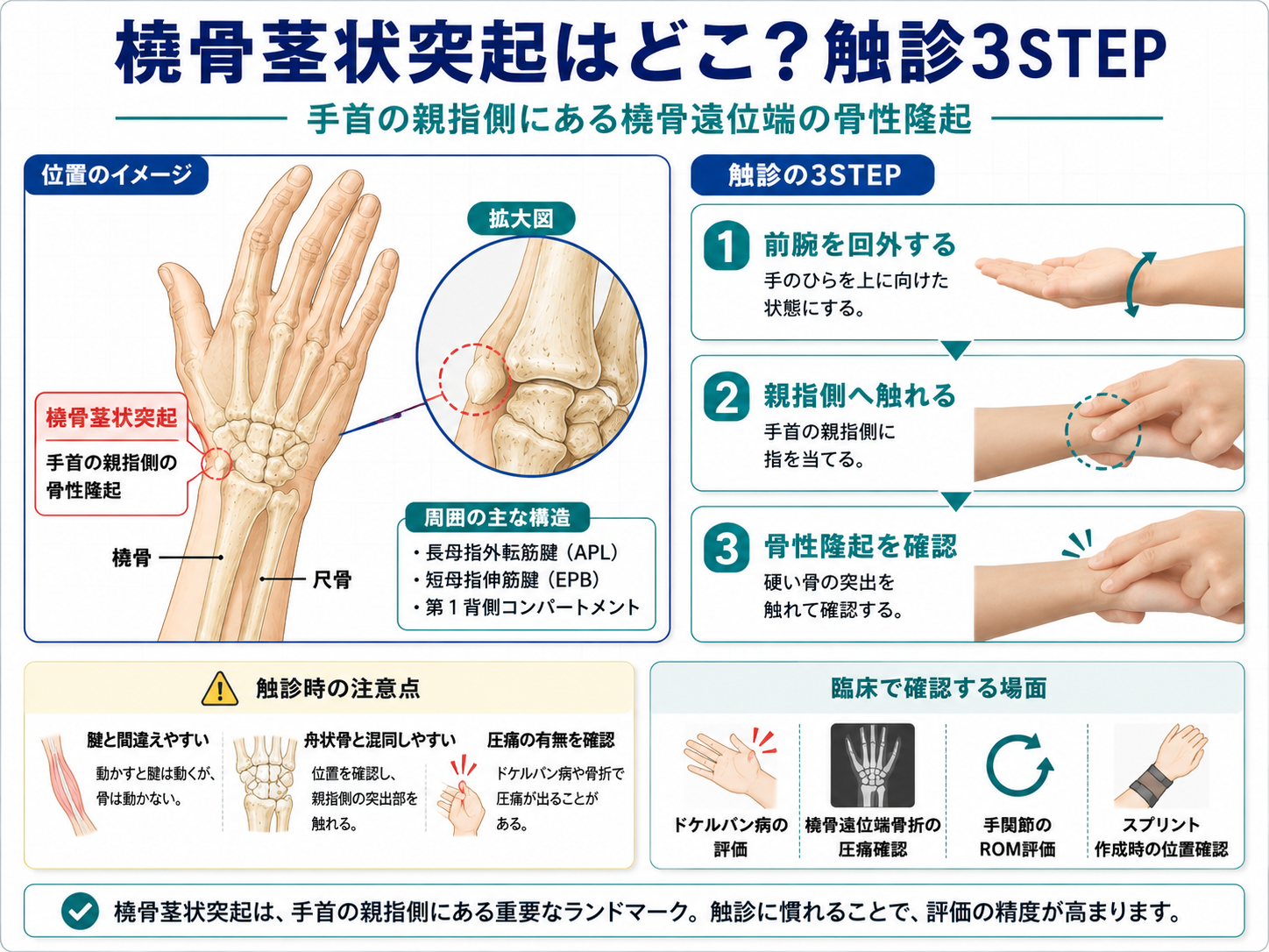橈骨茎状突起の位置と触診3STEPを示した図版