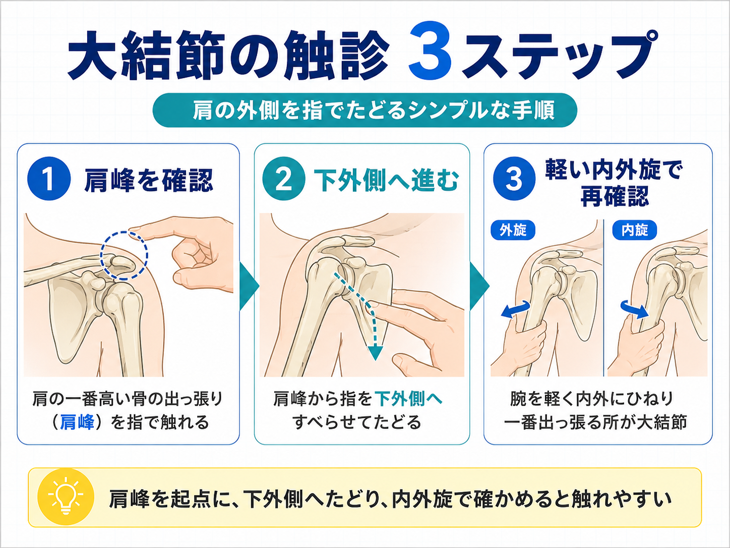 大結節の触診手順を肩峰確認、下外側への移動、内外旋での再確認の3ステップで示した図版