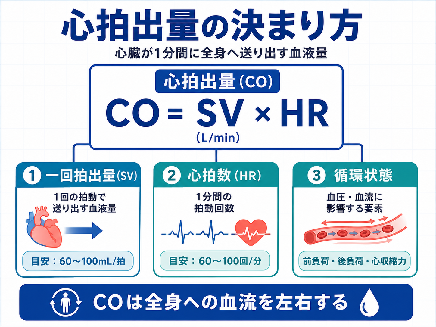 心拍出量の決まり方をCO、SV、HR、循環状態の関係で整理した図版