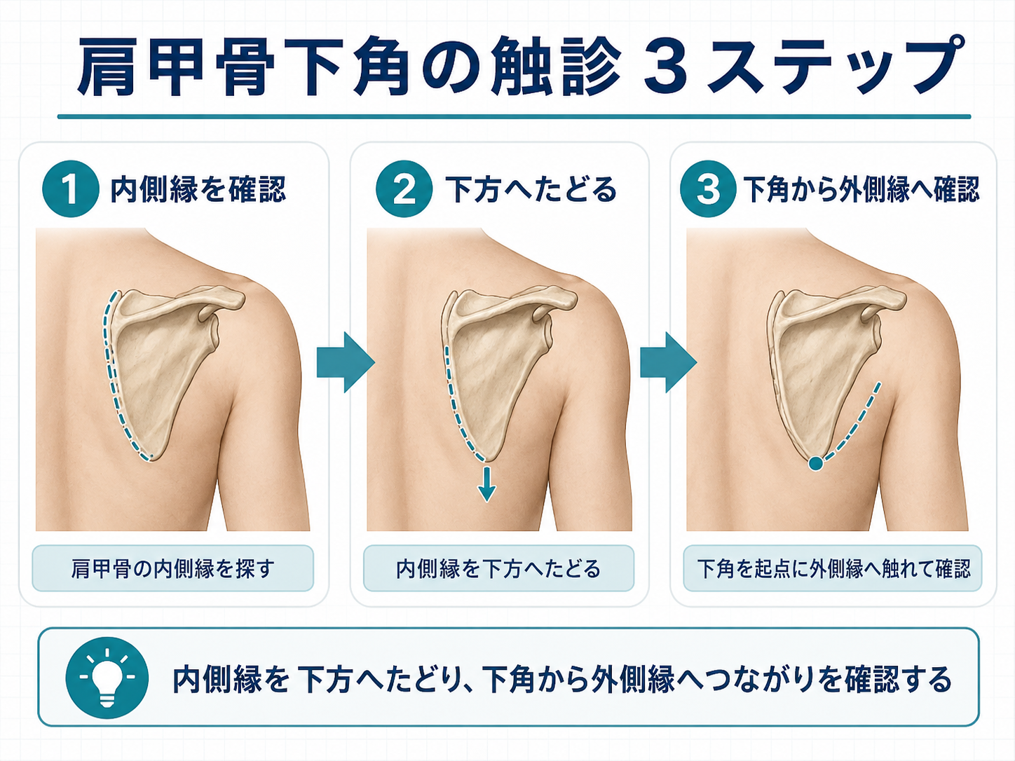 肩甲骨下角の触診3ステップを示した図版