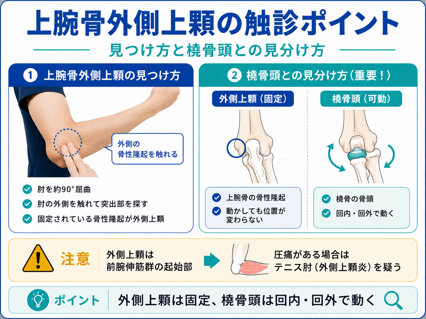 上腕骨外側上顆の触診ポイントと橈骨頭との見分け方を示した図版